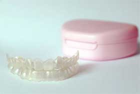 マウスピースを使用してホームホワイトニング